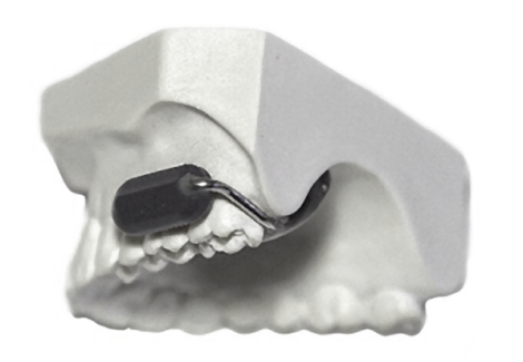 Bộ Quốc phòng Hoa Kỳ chi hàng triệu USD để phát triển điện thoại gắn vào răng - Ảnh 2. Bộ Quốc phòng Hoa Kỳ chi hàng triệu USD để phát triển điện thoại gắn vào răng - Ảnh 2.