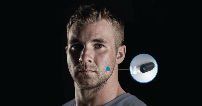 Bộ Quốc phòng Hoa Kỳ chi hàng triệu USD để phát triển điện thoại gắn vào răng - Ảnh 1. Bộ Quốc phòng Hoa Kỳ chi hàng triệu USD để phát triển điện thoại gắn vào răng - Ảnh 1.